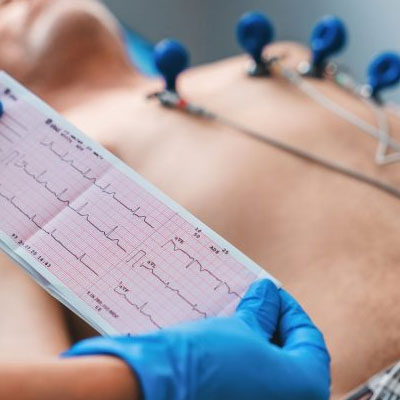 ECG